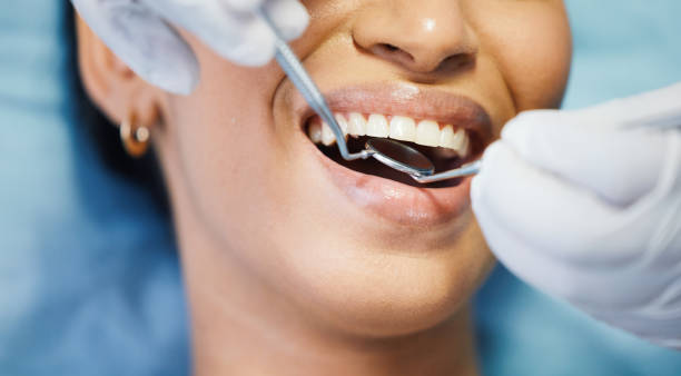 Best Emergency Treatment for Dental Infections or Abscesses in Madera Acres, CA